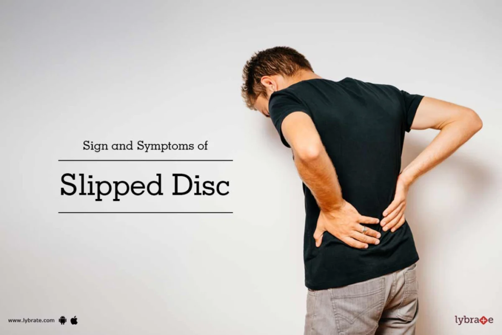 How to heal a bulging disc naturally: Holistic Approaches for Pain Relief