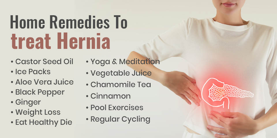 Home Remedies for Umbilical Hernia: Navigating Comfort and Healing