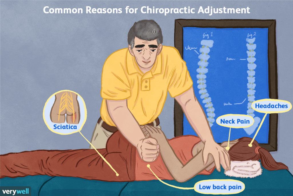 Chiropractic Treatment for Sciatica: Unlocking Relief