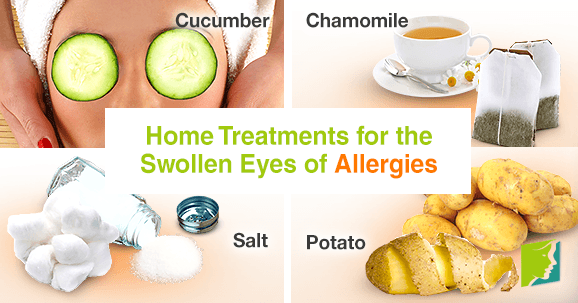 Home Remedies for Eyelid Swelling