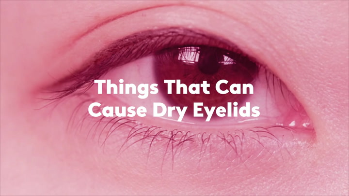 Home Remedies for Eyelid Swelling